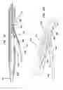 Fig. 12 - Systems and methods for creating arteriovenous (AV) fistulas