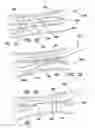 Fig. 17 - Systems and methods for creating arteriovenous (AV) fistulas