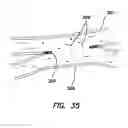 Fig. 18 - Systems and methods for creating arteriovenous (AV) fistulas