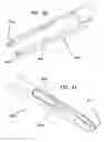 Fig. 21 - Systems and methods for creating arteriovenous (AV) fistulas