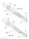 Fig. 22 - Systems and methods for creating arteriovenous (AV) fistulas