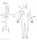 Fig. 01 - Automatic treatment of pain