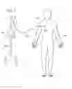 Fig. 03 - Automatic treatment of pain