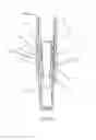 Fig. 27 - Contact trigger release needle guard