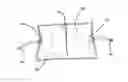 Fig. 01 - Insufflation stabilization system