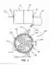 Fig. 03 - Insufflation stabilization system