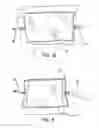 Fig. 06 - Insufflation stabilization system