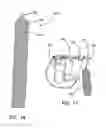 Fig. 12 - Insufflation stabilization system