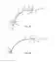 Fig. 03 - METHODS FOR PREVENTING TRACHEAL ASPIRATION