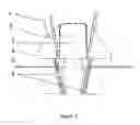 Fig. 03 - VENTILATION WITH A VIEW MASK