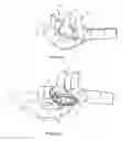 Fig. 03 - Breathing assistance apparatus