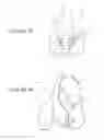 Fig. 24 - Pressure controlled exhaust vent