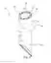Fig. 05 - AORTIC CANNULA WITH DE-AIR FUNCTION