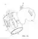 Fig. 03 - Catheter fixing band
