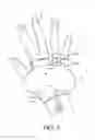 Fig. 07 - Catheter fixing band