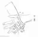 Fig. 12 - Catheter fixing band
