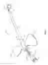 Fig. 02 - Systems and methods for venipuncture and catheter placement