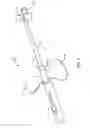 Fig. 07 - Systems and methods for venipuncture and catheter placement