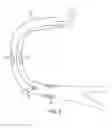 Fig. 05 - Guide wires, catheters, and guide wire catheter systems and methods