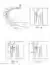 Fig. 14 - Guide wires, catheters, and guide wire catheter systems and methods