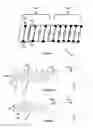 Fig. 04 - Guidewire with torque transmission element