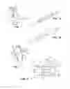 Fig. 02 - Perfusion system for treating cardiac rhythm disturbances