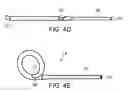 Fig. 06 - Systems and method for bypassing an anastomosis site