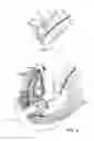 Fig. 09 - Systems and method for bypassing an anastomosis site
