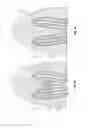 Fig. 09 - Microelectrode and multiple microelectrodes