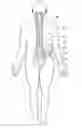 Fig. 01 - Lead electrode for use in an MRI-safe implantable medical device