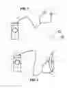 Fig. 02 - Transcutaneous electrostimulator and methods for electric stimulation
