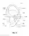 Fig. 09 - Transcutaneous electrostimulator and methods for electric stimulation