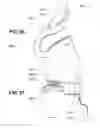 Fig. 16 - Transcutaneous electrostimulator and methods for electric stimulation