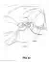 Fig. 19 - Transcutaneous electrostimulator and methods for electric stimulation