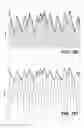 Fig. 57 - Transcutaneous electrostimulator and methods for electric stimulation