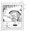 Fig. 01 - User interface with 3D environment for configuring stimulation therapy