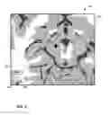 Fig. 09 - User interface with 3D environment for configuring stimulation therapy