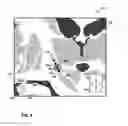 Fig. 10 - User interface with 3D environment for configuring stimulation therapy