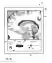 Fig. 30 - User interface with 3D environment for configuring stimulation therapy