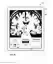 Fig. 37 - User interface with 3D environment for configuring stimulation therapy