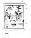 Fig. 45 - User interface with 3D environment for configuring stimulation therapy