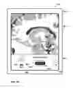 Fig. 60 - User interface with 3D environment for configuring stimulation therapy