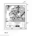 Fig. 61 - User interface with 3D environment for configuring stimulation therapy