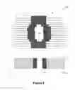 Fig. 03 - Proton therapy multi-leaf collimator beam shaping