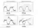 Fig. 07 - Systems and methods for rehabilitation of limb motion