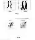 Fig. 19 - Systems and methods for rehabilitation of limb motion