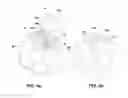 Fig. 06 - Motion sensing device which provides a visual indication with a wireless signal