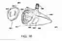 Fig. 13 - Golf club head