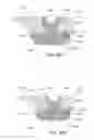 Fig. 52 - Golf club head