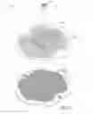 Fig. 03 - ADHESIVE TOY BEADS